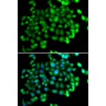 Immunofluorescence - Anti-APOBEC3C Antibody (A5877) - Antibodies.com