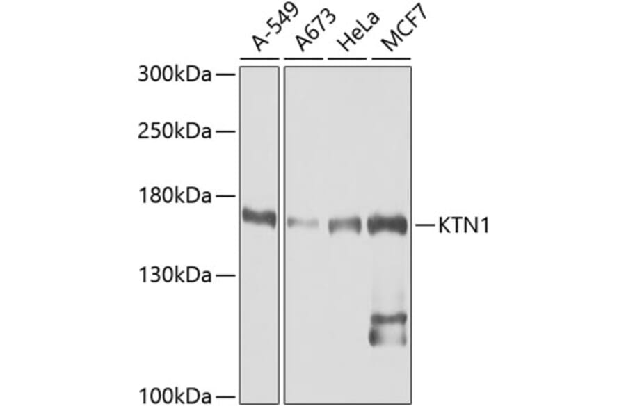 Western Blot - Anti-KTN1 Antibody (A5879) - Antibodies.com