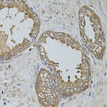 Immunohistochemistry - Anti-KTN1 Antibody (A5879) - Antibodies.com