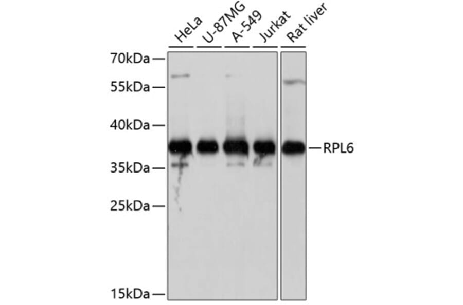 Western Blot - Anti-RPL6 Antibody (A5881) - Antibodies.com