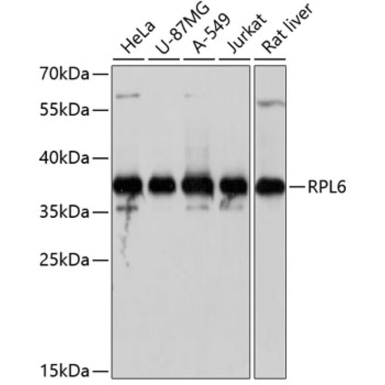 Western Blot - Anti-RPL6 Antibody (A5881) - Antibodies.com