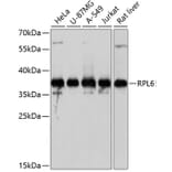 Western Blot - Anti-RPL6 Antibody (A5881) - Antibodies.com