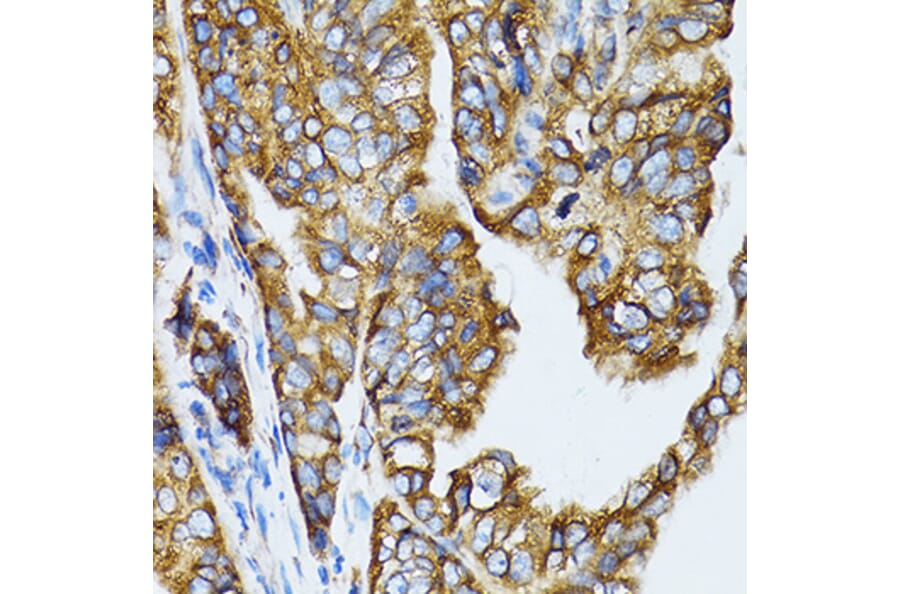 Immunohistochemistry - Anti-RPL6 Antibody (A5881) - Antibodies.com