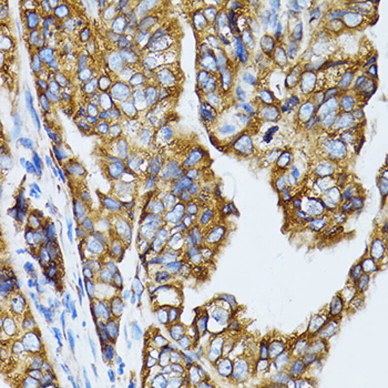Immunohistochemistry - Anti-RPL6 Antibody (A5881) - Antibodies.com