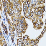 Immunohistochemistry - Anti-RPL6 Antibody (A5881) - Antibodies.com