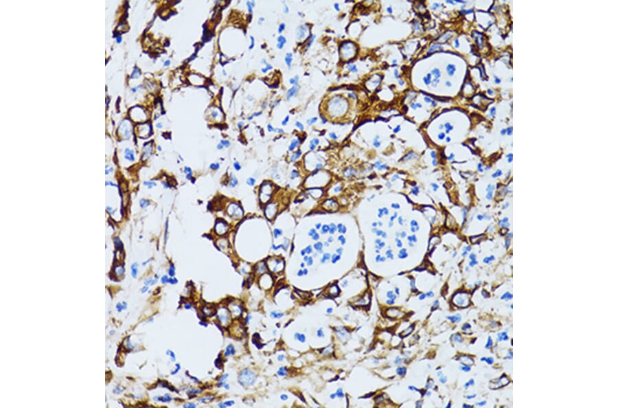 Immunohistochemistry - Anti-RPL6 Antibody (A5881) - Antibodies.com