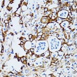 Immunohistochemistry - Anti-RPL6 Antibody (A5881) - Antibodies.com
