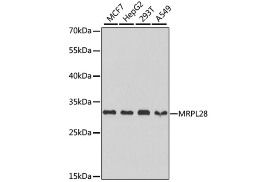 Western Blot - Anti-MRPL28 Antibody (A9764) - Antibodies.com