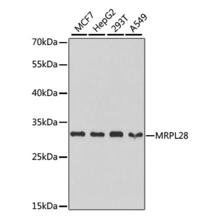 Western Blot - Anti-MRPL28 Antibody (A9764) - Antibodies.com