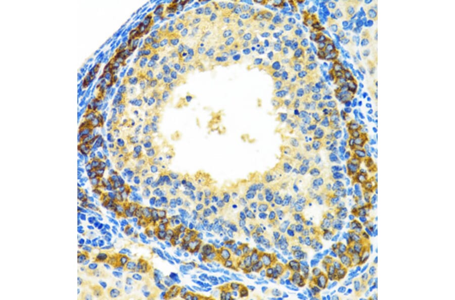 Immunohistochemistry - Anti-MRPL28 Antibody (A9764) - Antibodies.com