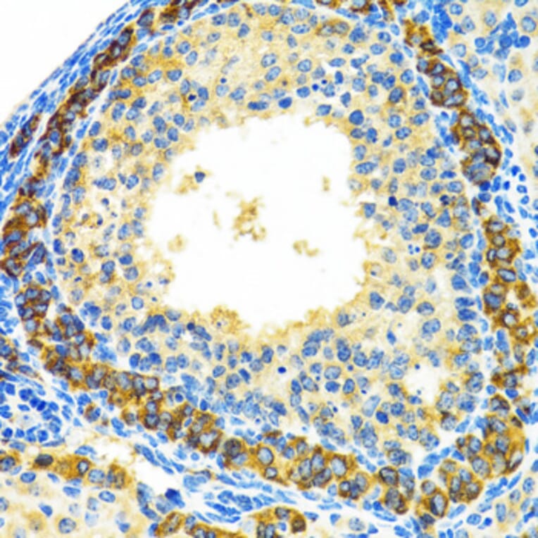 Immunohistochemistry - Anti-MRPL28 Antibody (A9764) - Antibodies.com