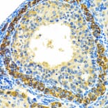 Immunohistochemistry - Anti-MRPL28 Antibody (A9764) - Antibodies.com
