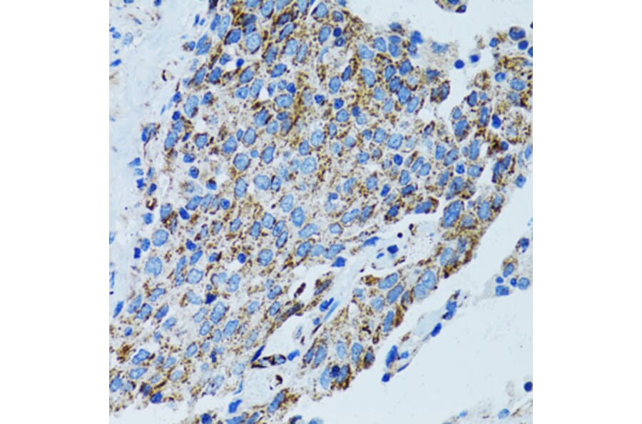 Immunohistochemistry - Anti-MRPL28 Antibody (A9764) - Antibodies.com