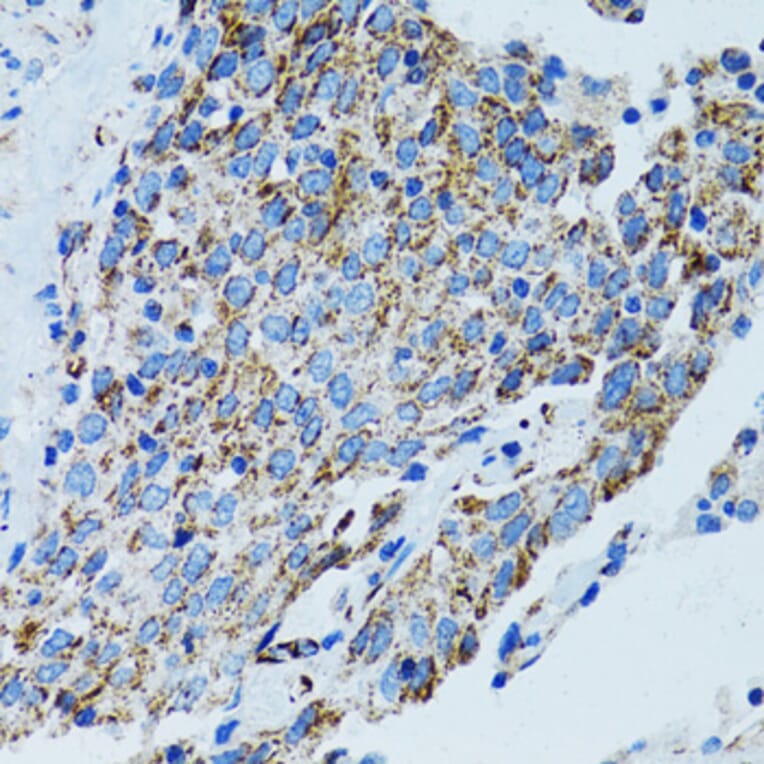 Immunohistochemistry - Anti-MRPL28 Antibody (A9764) - Antibodies.com