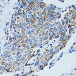 Immunohistochemistry - Anti-MRPL28 Antibody (A9764) - Antibodies.com