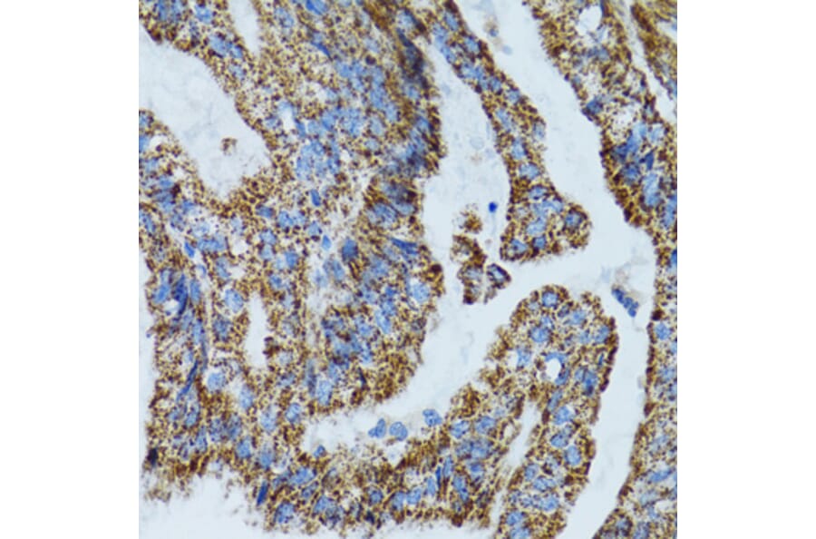 Immunohistochemistry - Anti-MRPL28 Antibody (A9764) - Antibodies.com