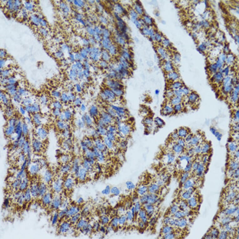 Immunohistochemistry - Anti-MRPL28 Antibody (A9764) - Antibodies.com