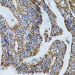 Immunohistochemistry - Anti-MRPL28 Antibody (A9764) - Antibodies.com