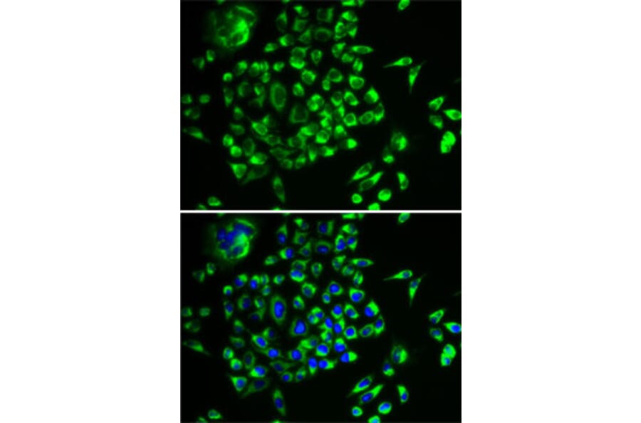 Immunofluorescence - Anti-MRPL28 Antibody (A9764) - Antibodies.com