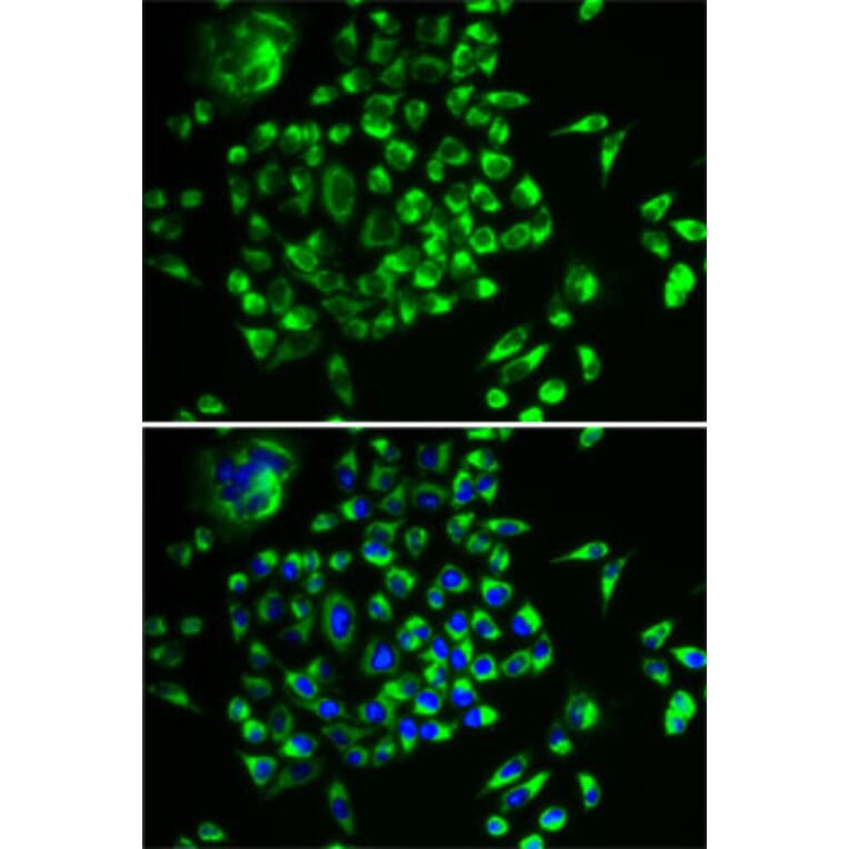 Immunofluorescence - Anti-MRPL28 Antibody (A9764) - Antibodies.com