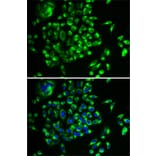 Immunofluorescence - Anti-MRPL28 Antibody (A9764) - Antibodies.com