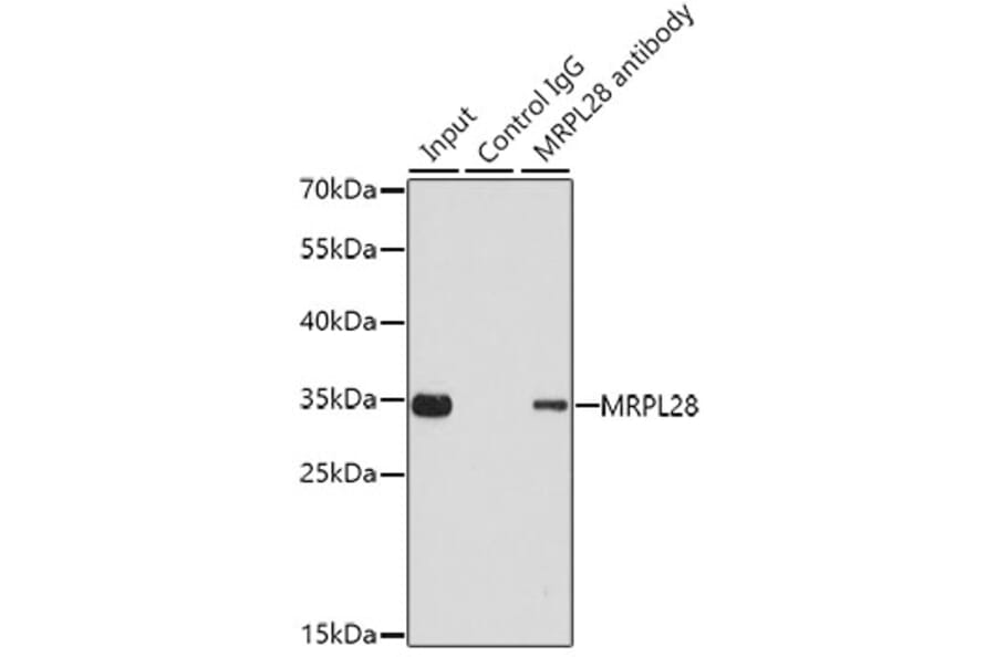 Western Blot - Anti-MRPL28 Antibody (A9764) - Antibodies.com