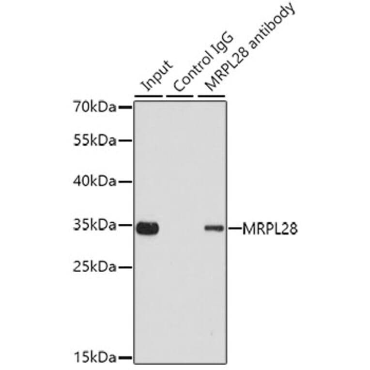 Western Blot - Anti-MRPL28 Antibody (A9764) - Antibodies.com