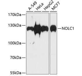 Western Blot - Anti-NOLC1 Antibody (A9765) - Antibodies.com