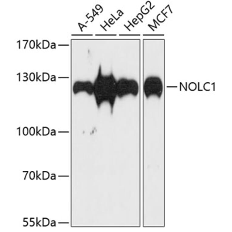 Western Blot - Anti-NOLC1 Antibody (A9765) - Antibodies.com