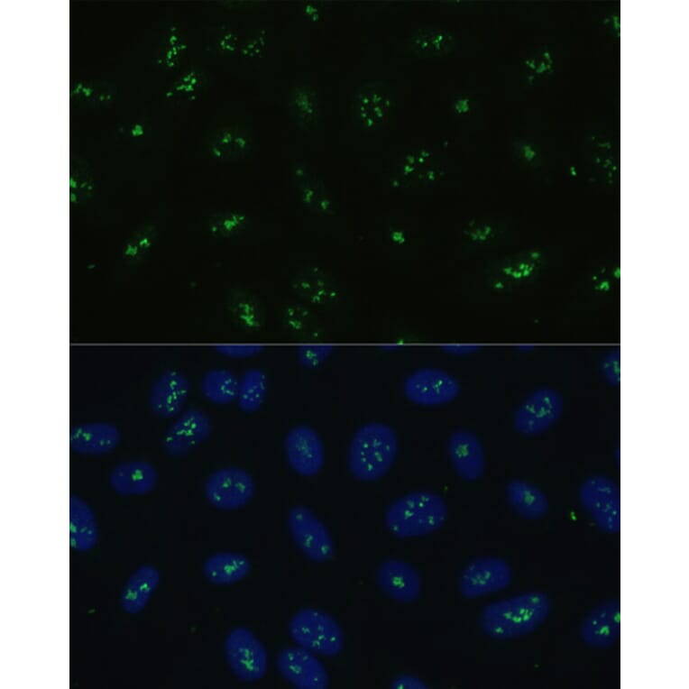 Immunofluorescence - Anti-NOLC1 Antibody (A9765) - Antibodies.com