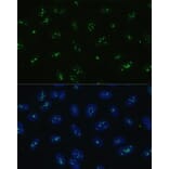 Immunofluorescence - Anti-NOLC1 Antibody (A9765) - Antibodies.com