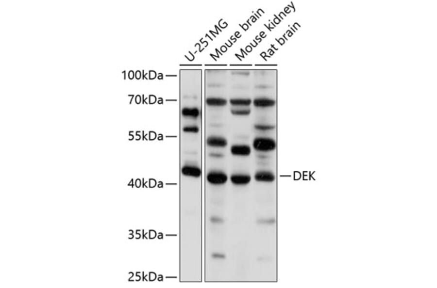 Western Blot - Anti-DEK Antibody (A5901) - Antibodies.com