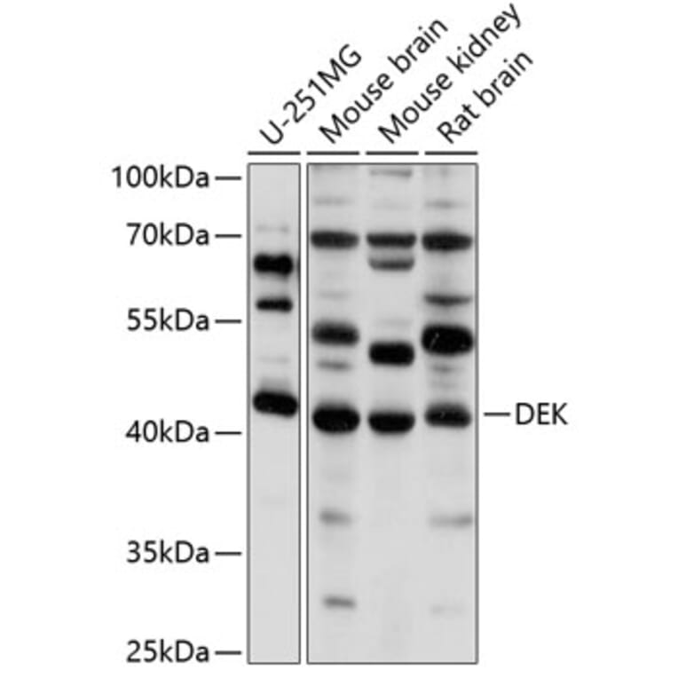 Western Blot - Anti-DEK Antibody (A5901) - Antibodies.com