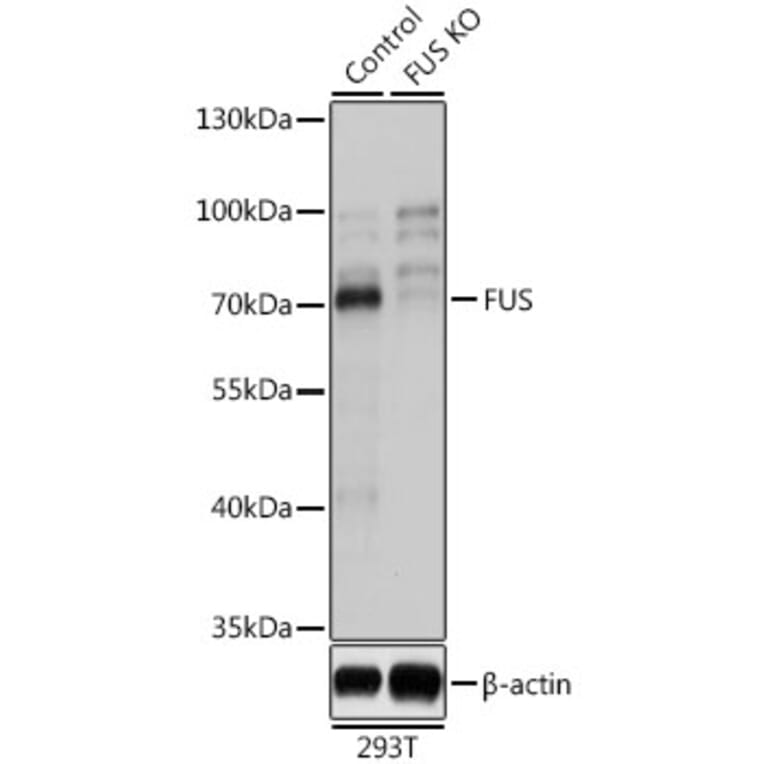 Western Blot - Anti-TLS/FUS Antibody (A9768) - Antibodies.com