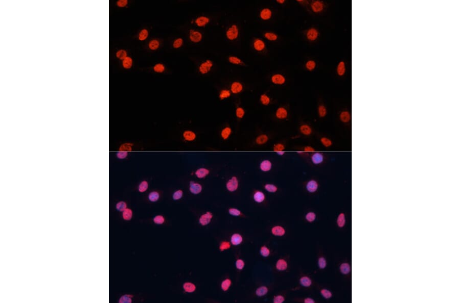 Immunofluorescence - Anti-TLS/FUS Antibody (A9768) - Antibodies.com