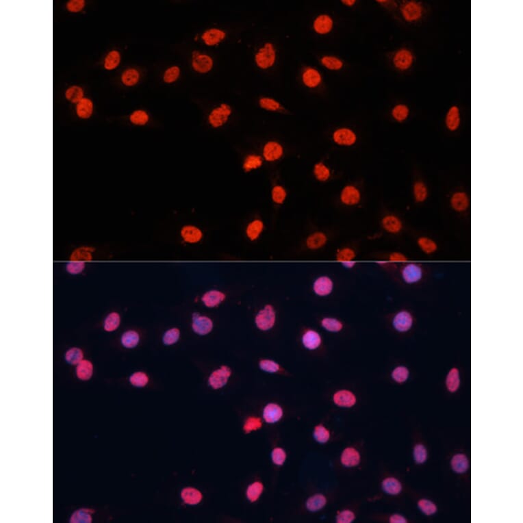 Immunofluorescence - Anti-TLS/FUS Antibody (A9768) - Antibodies.com