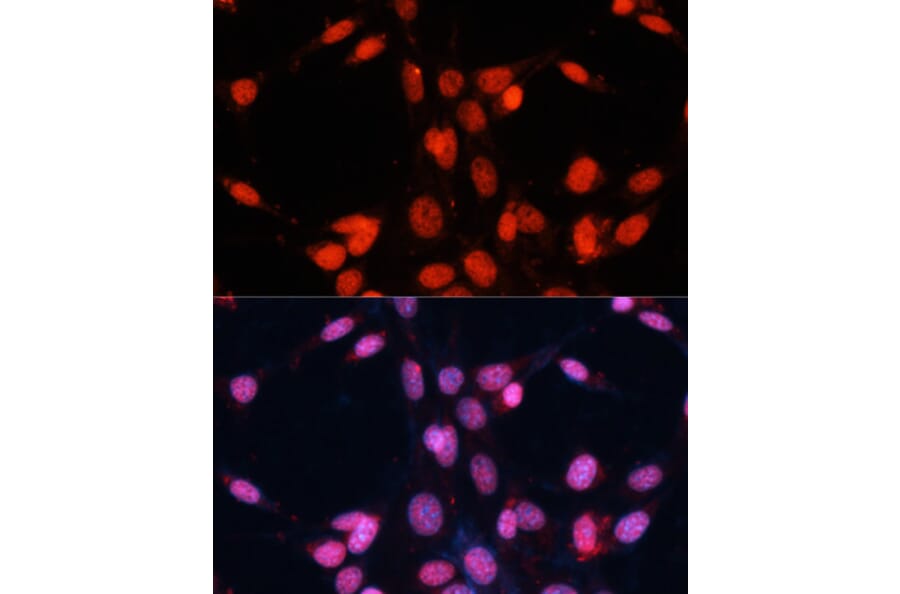 Immunofluorescence - Anti-TLS/FUS Antibody (A9768) - Antibodies.com