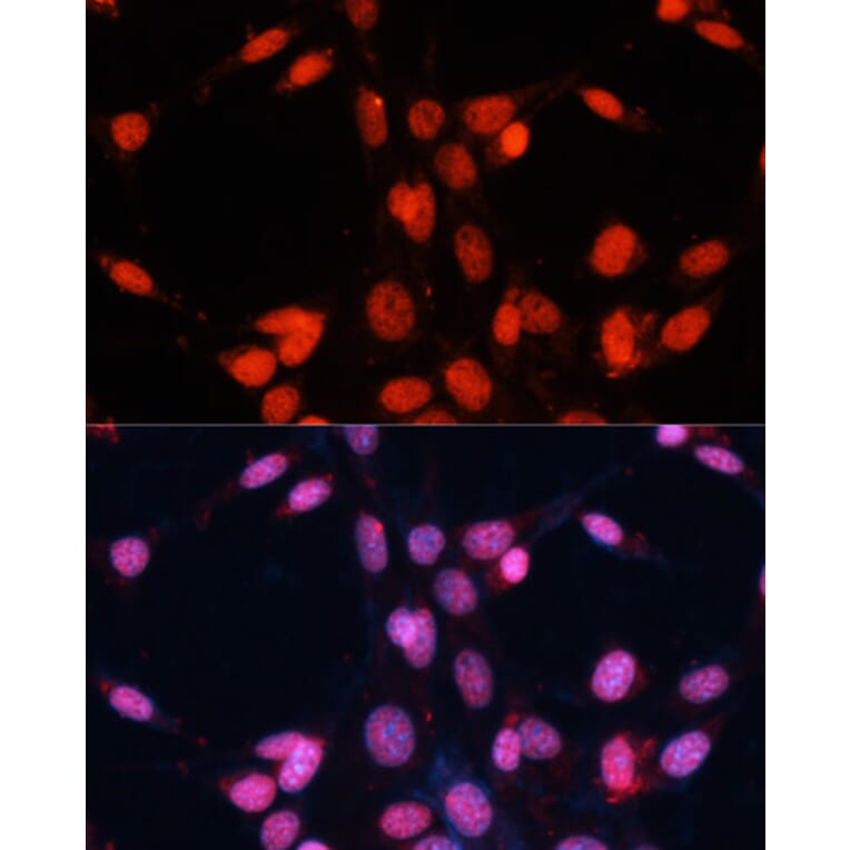 Immunofluorescence - Anti-TLS/FUS Antibody (A9768) - Antibodies.com