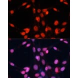 Immunofluorescence - Anti-TLS/FUS Antibody (A9768) - Antibodies.com