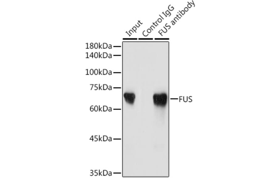 Western Blot - Anti-TLS/FUS Antibody (A9768) - Antibodies.com