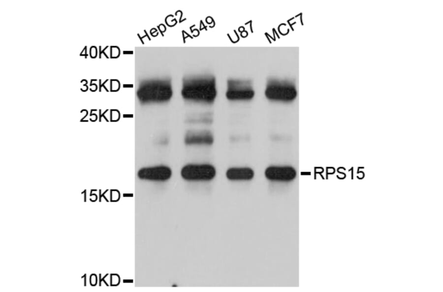Western Blot - Anti-RPS15 Antibody (A5938) - Antibodies.com