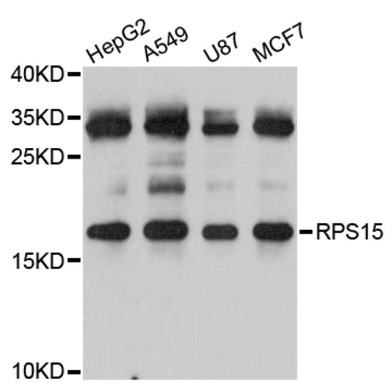 Western Blot - Anti-RPS15 Antibody (A5938) - Antibodies.com