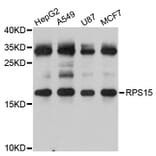 Western Blot - Anti-RPS15 Antibody (A5938) - Antibodies.com