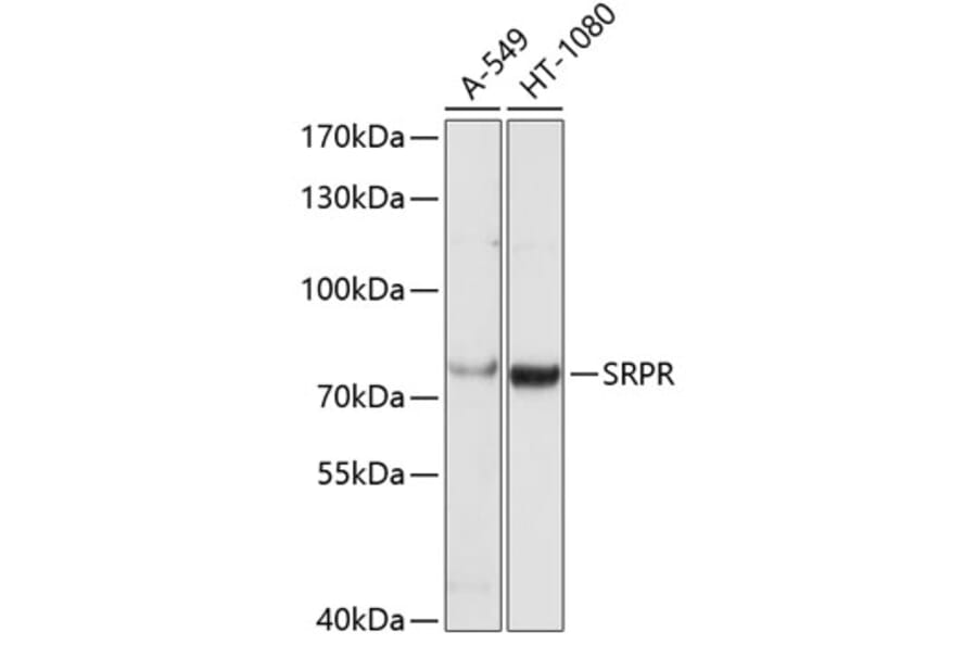 Western Blot - Anti-SRPR alpha Antibody (A9770) - Antibodies.com