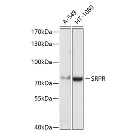 Western Blot - Anti-SRPR alpha Antibody (A9770) - Antibodies.com