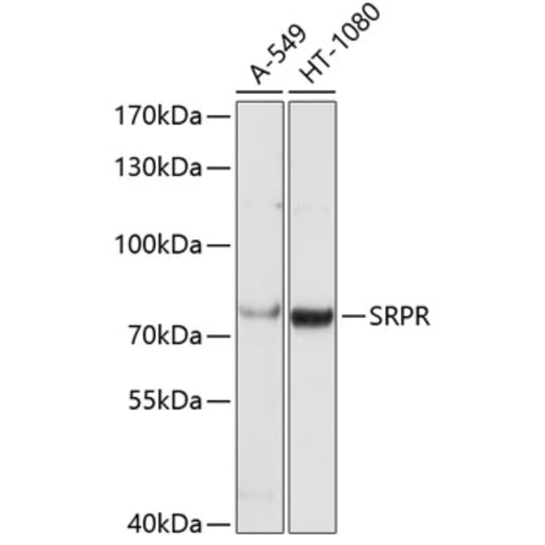 Western Blot - Anti-SRPR alpha Antibody (A9770) - Antibodies.com
