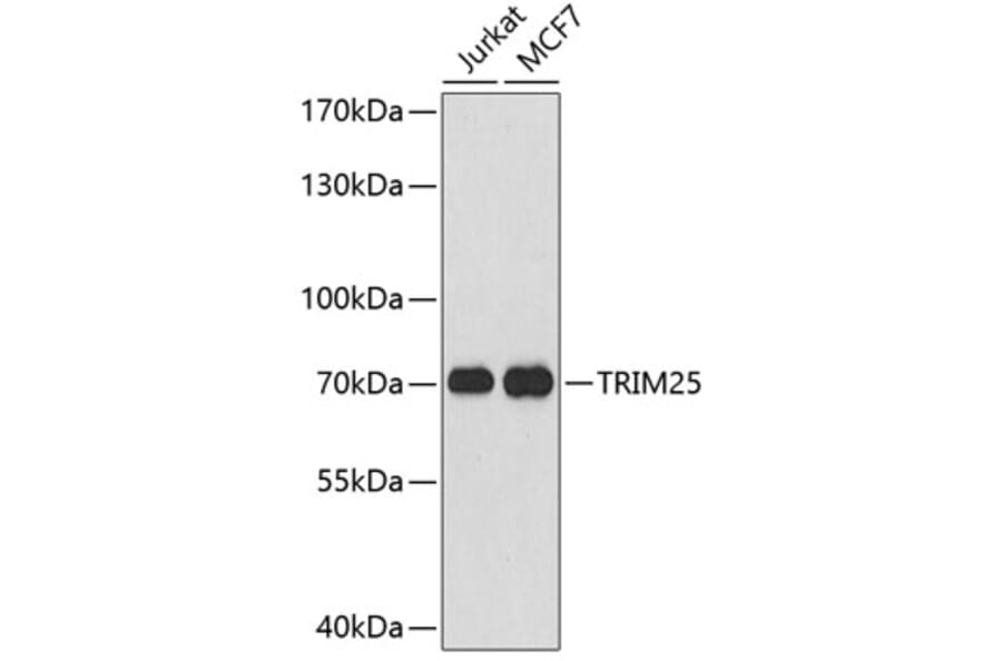 Western Blot - Anti-TRIM25 Antibody (A5940) - Antibodies.com