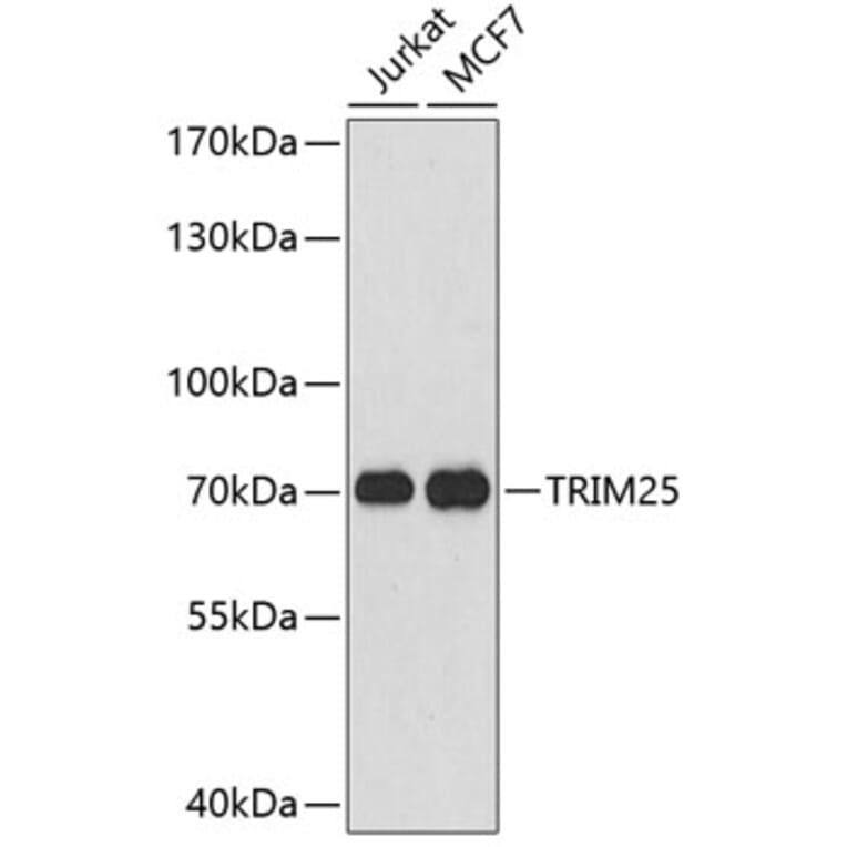 Western Blot - Anti-TRIM25 Antibody (A5940) - Antibodies.com