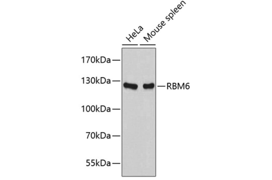 Western Blot - Anti-RBM6 Antibody (A5954) - Antibodies.com