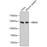 Western Blot - Anti-RBM6 Antibody (A5954) - Antibodies.com